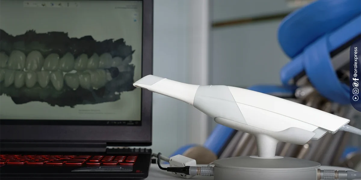 ¿Qué es el escáner intraoral y cómo funciona? ¿Qué es el escáner intraoral y cómo funciona?